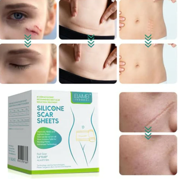 CicatriMax™ 3D - Fita de Silicone Cicatrizante 6 Em 1